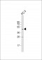 TAMM41 Antibody (Center)